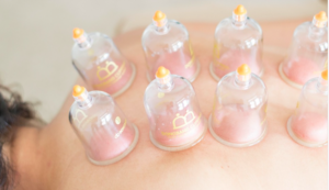 Wet cupping