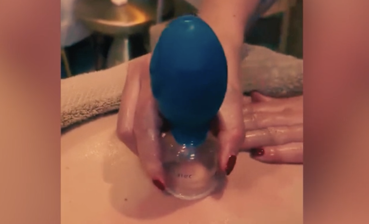 transformational cupping